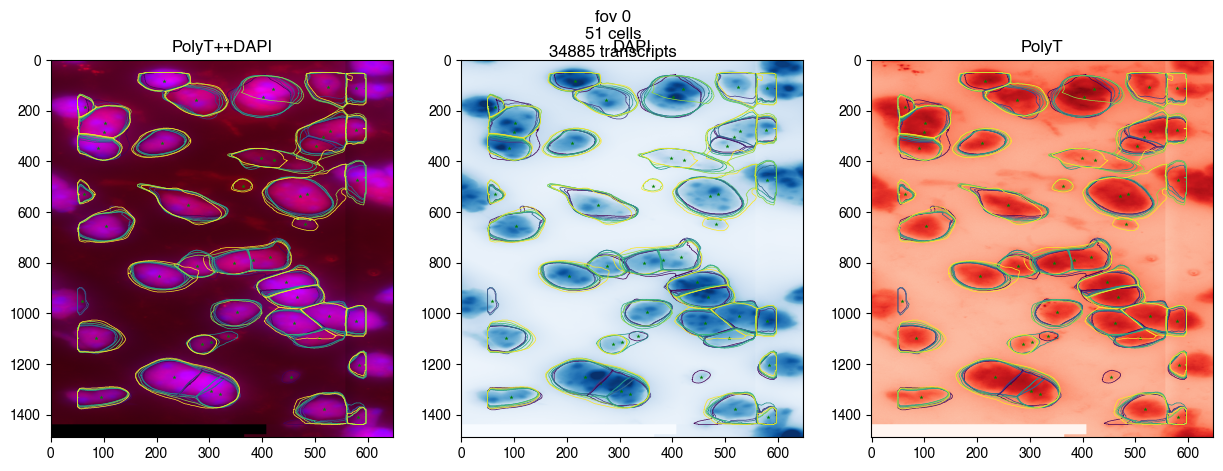 ../_images/04.cellpose_segmentation_10_0.png